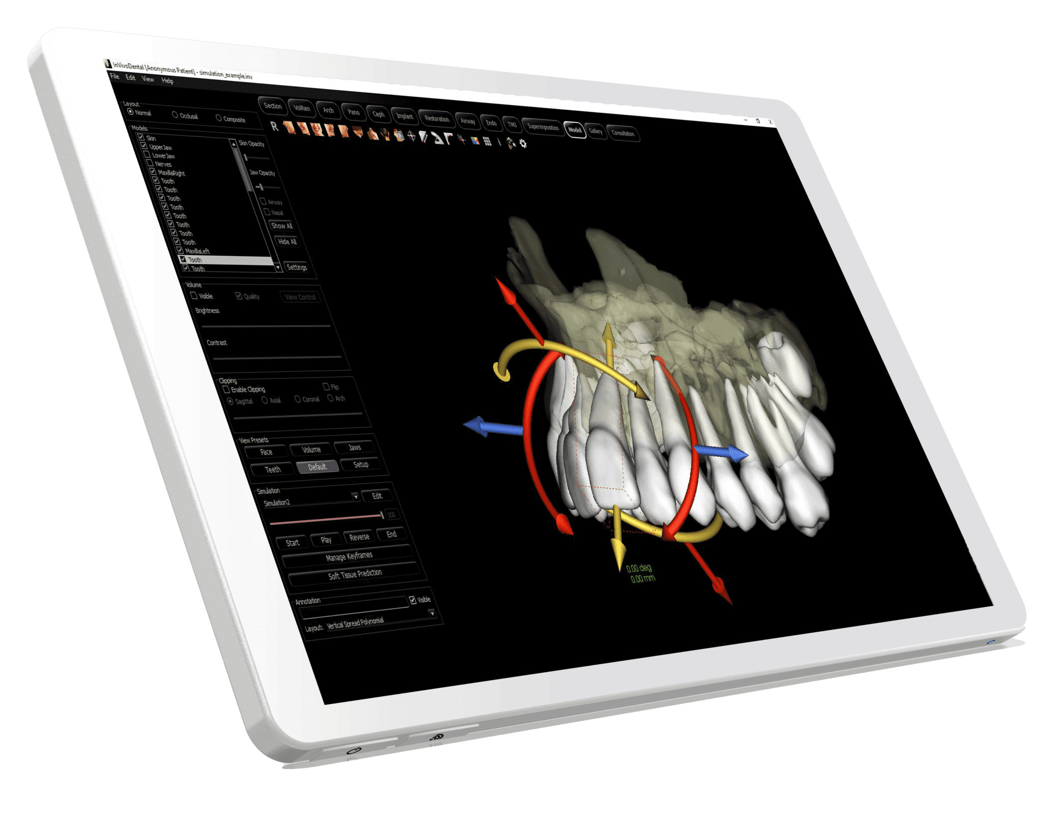 Invivo-Model-tablet-2048x1624